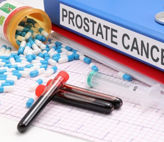 The Best Prostate Cancer Resources